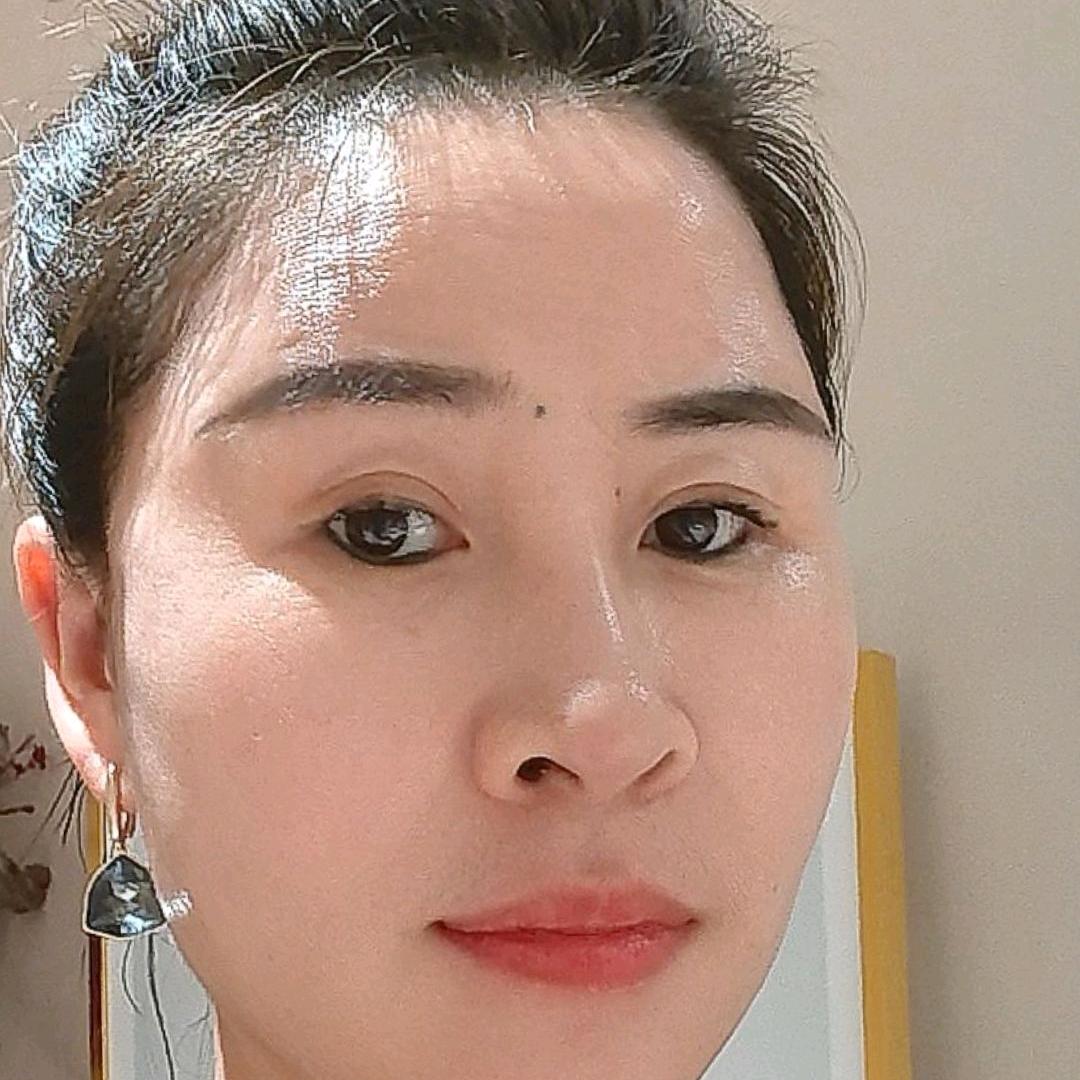 榆次小莲斑花1/问题肌