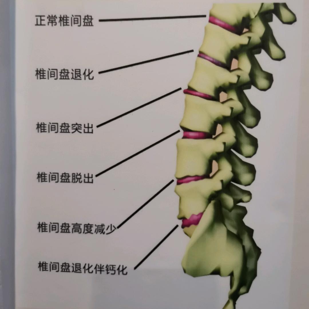健康理疗