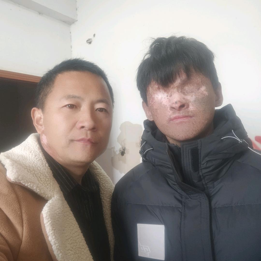 艺艺会看到光的