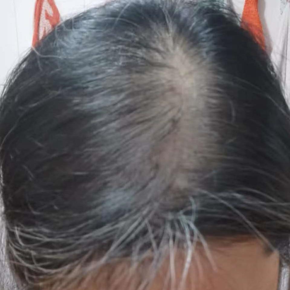 阿珍养发分享