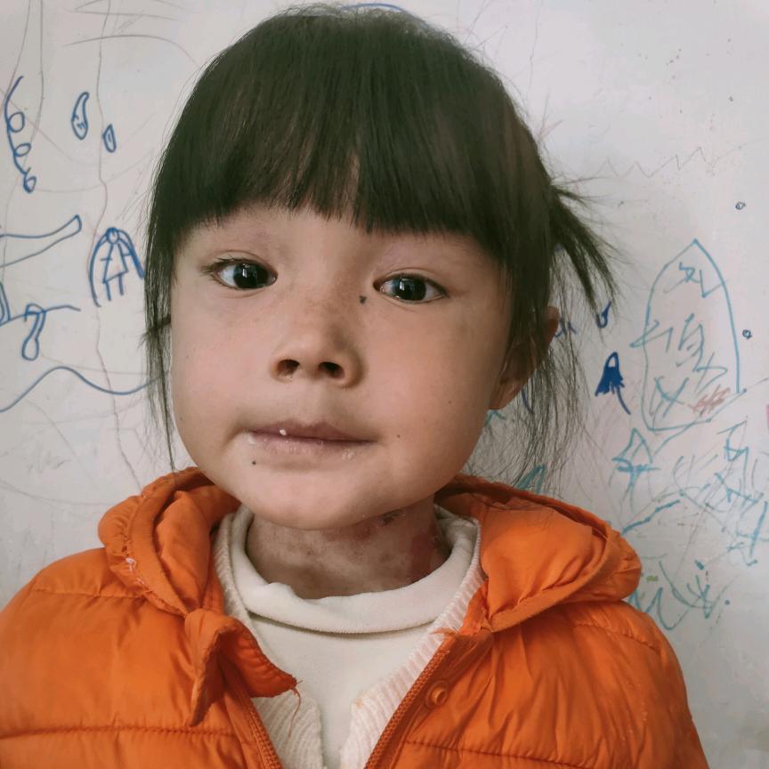 妹妹（蝴蝶宝贝）