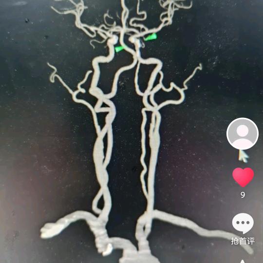 DR   CT   MR