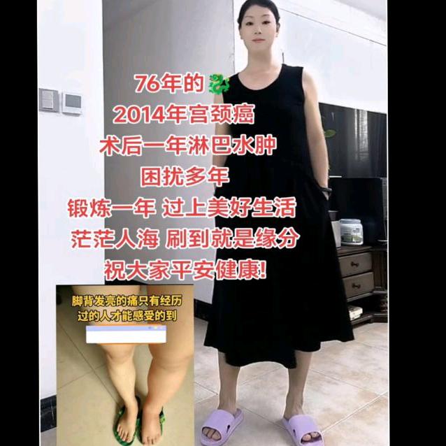 凤姐/ 淋巴水肿自愈之路