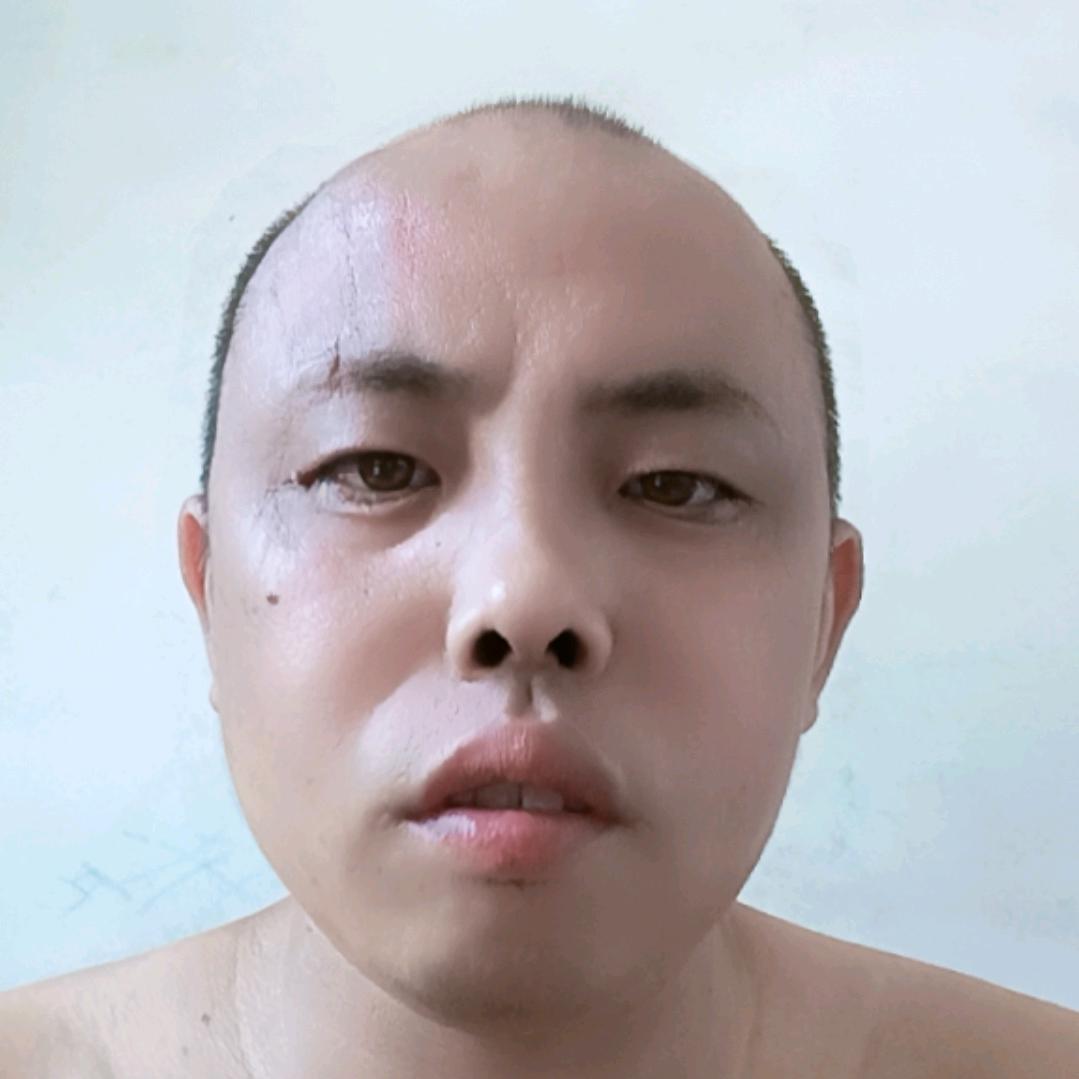 江西挖机转盘免拆修复，液压油过滤！