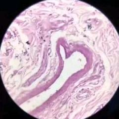 打烂瞎子那张好嘴