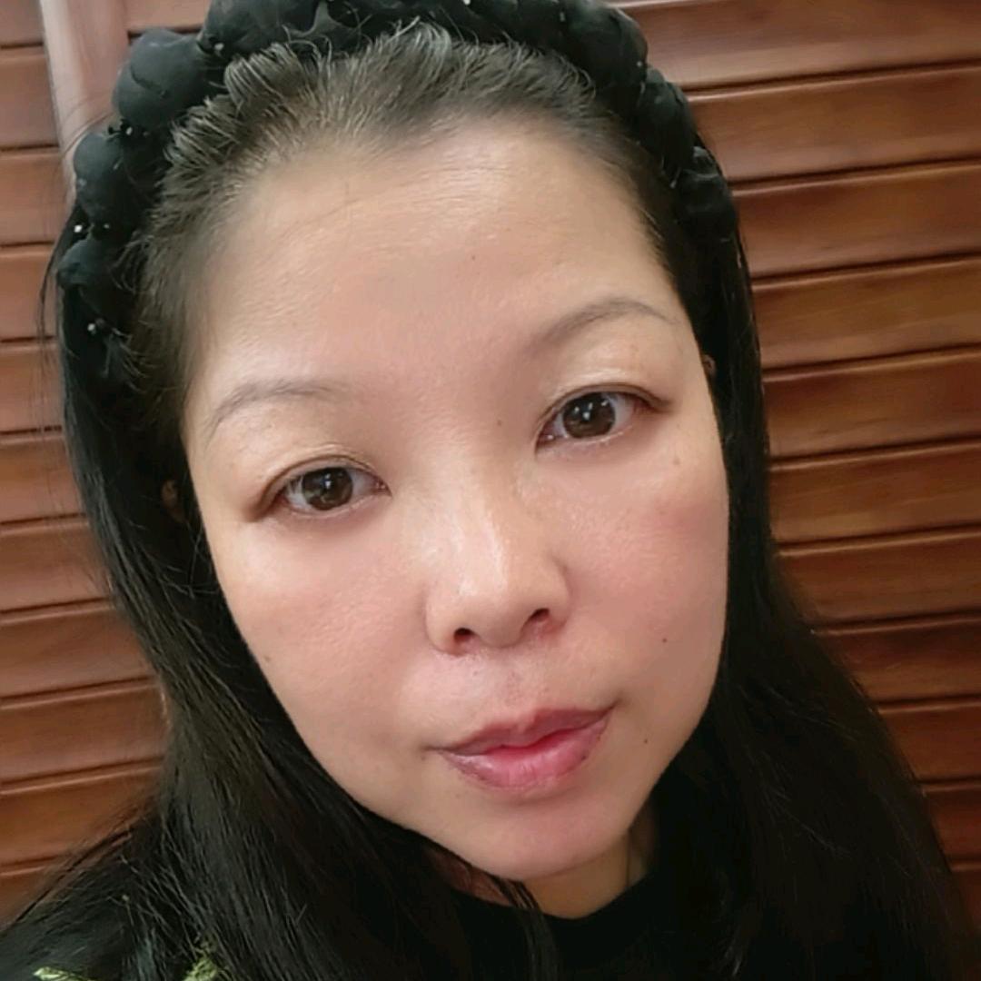 小龅牙心心