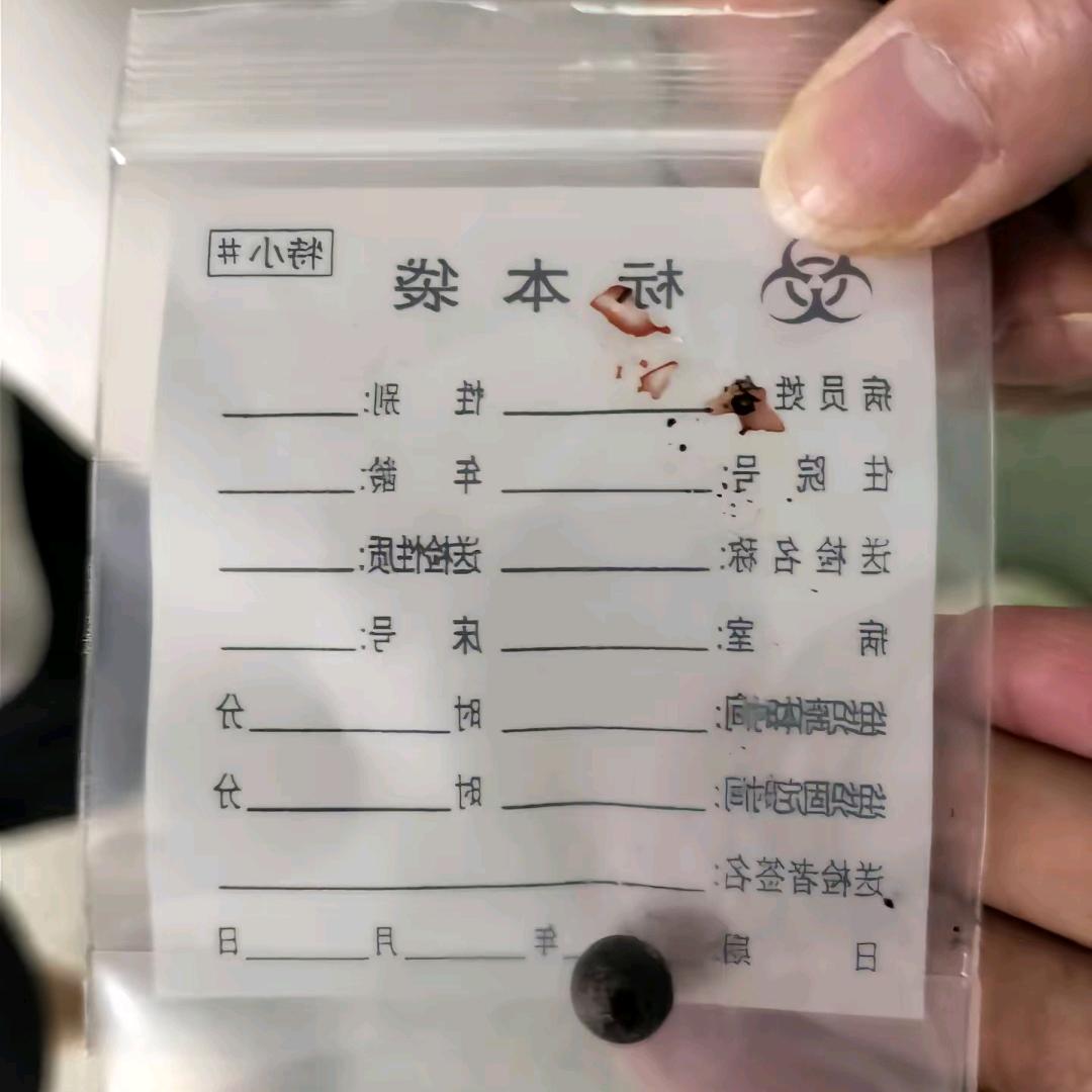 弹弓伤人事件