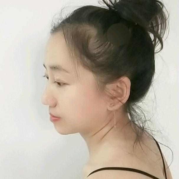 炎炎