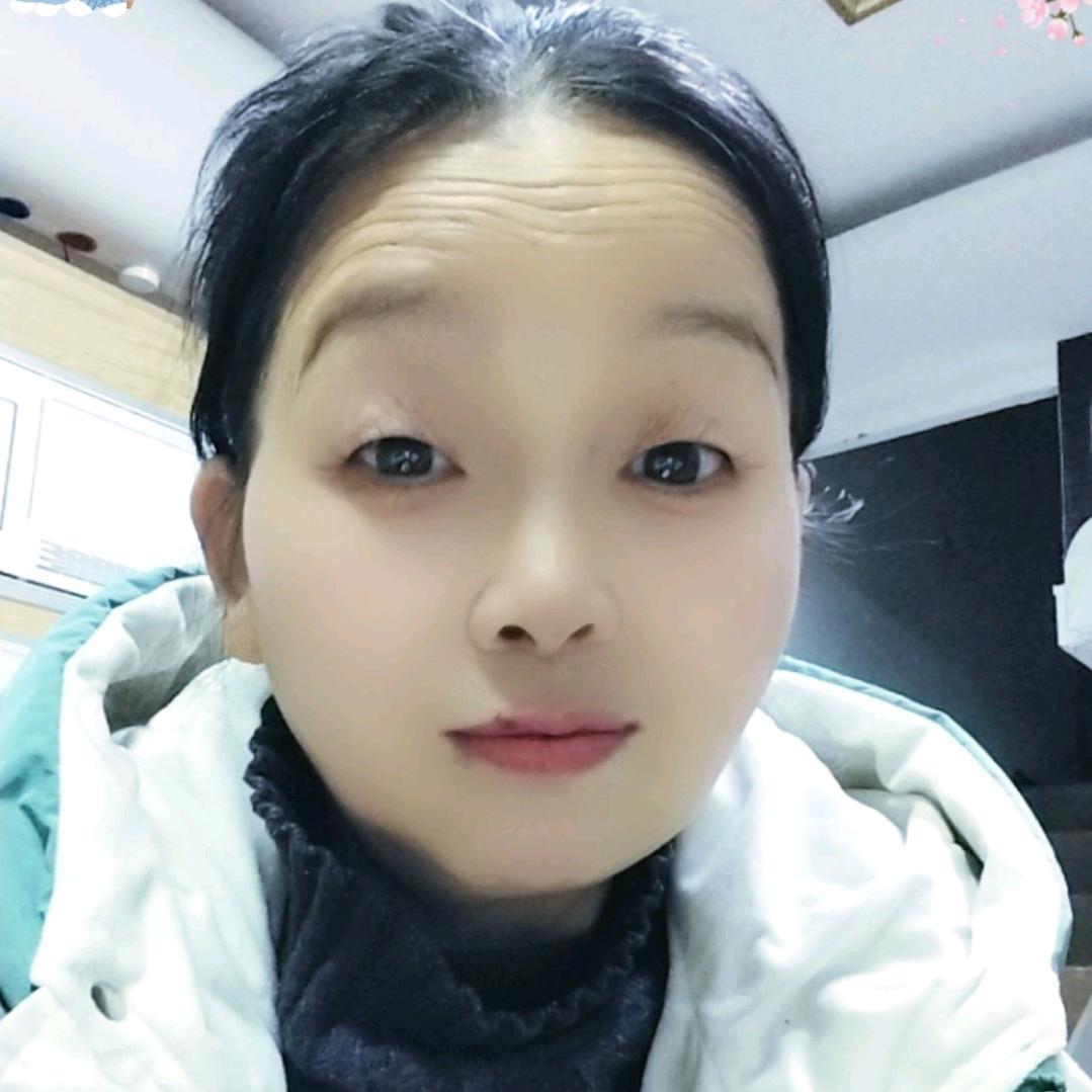 张姐