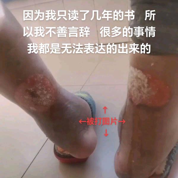 段旺先4孩单爹含障娘被恶首打爆废了身体脑