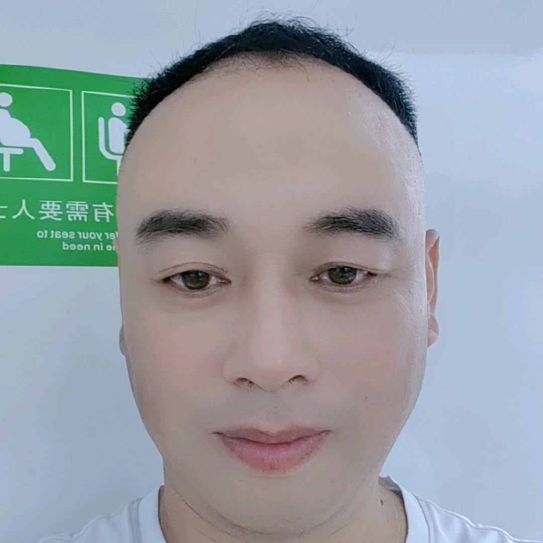 小元宝