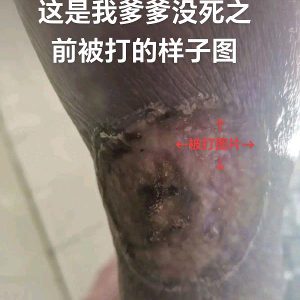 段旺先4孩单爹含障娘被恶首打爆废了身体脑