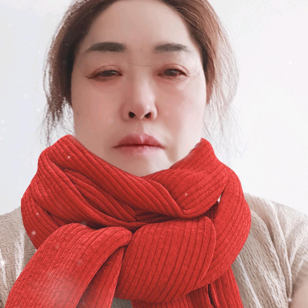 阿方