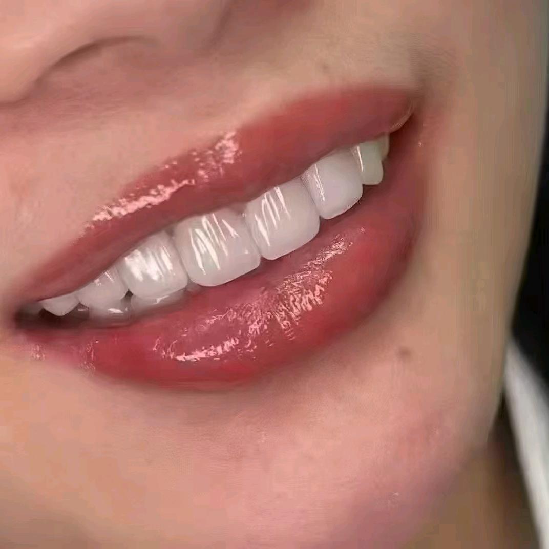 全瓷牙贴面加工厂