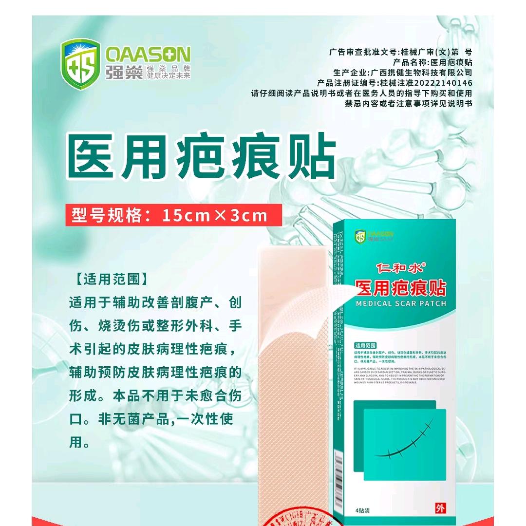 李琼
