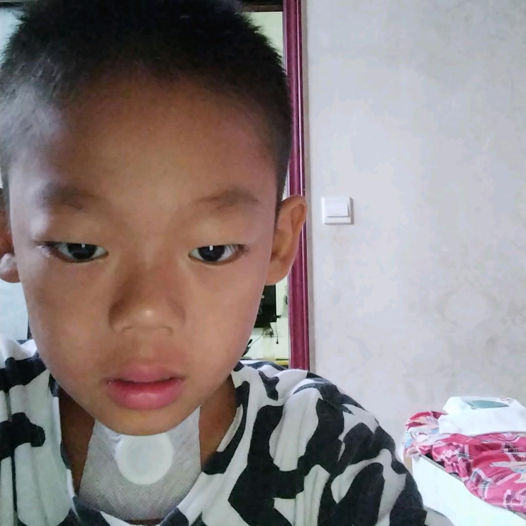 健光91
