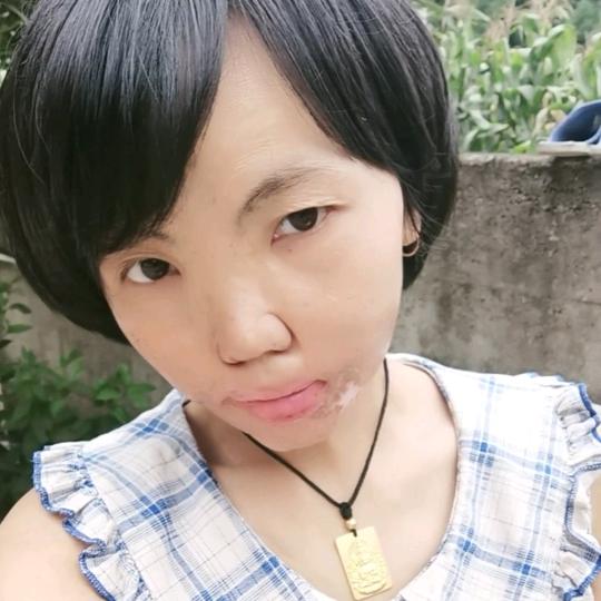 毁容的单身女孩