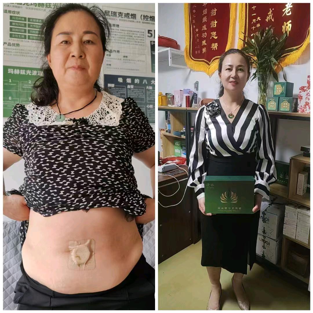 杨姐轻松戒烟