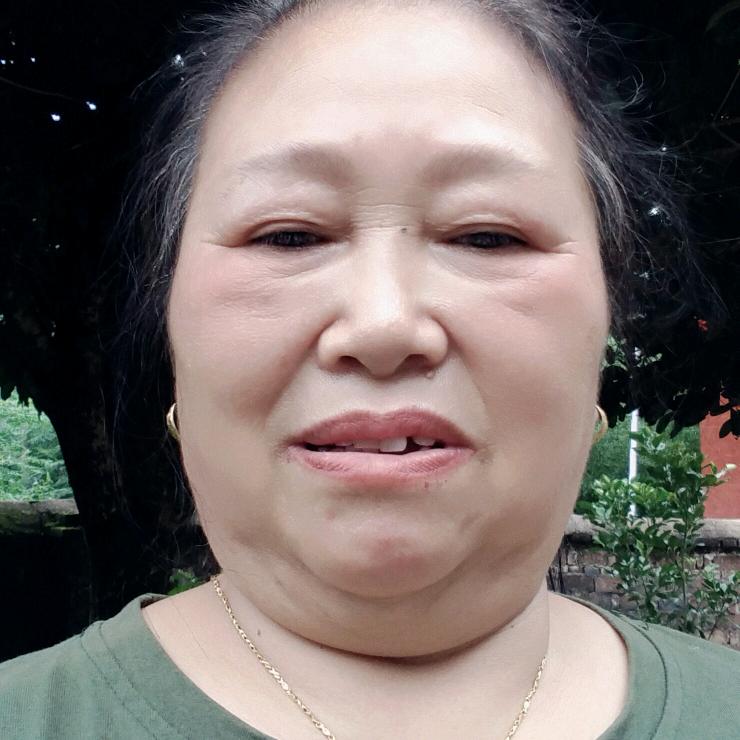 易荣奶