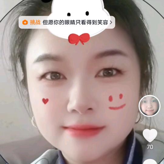 开心果
