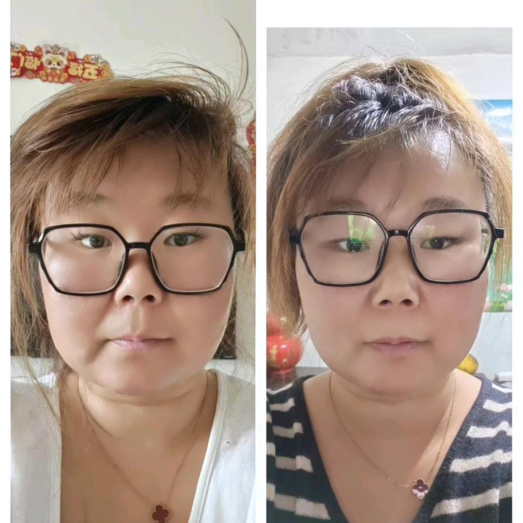 三丑  小丸子调理～减脂