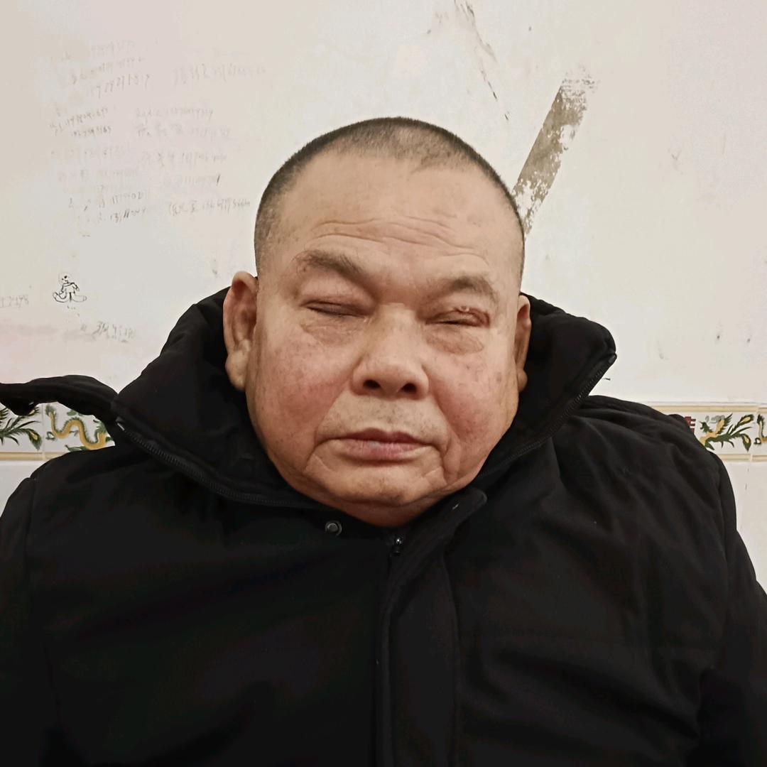 张芬元（大小号同名上午9:20复播）