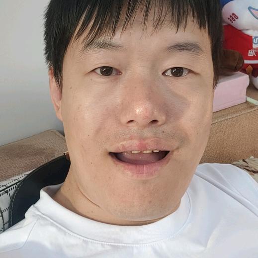 宁ӧ红阳