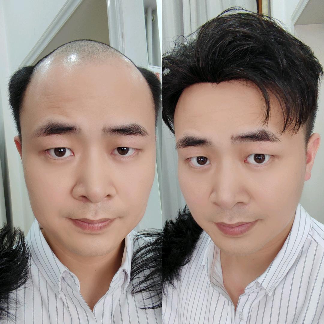 颖嘉美假发玮廷