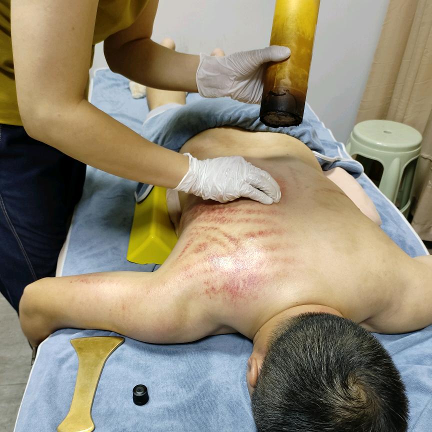 东莞专攻身体各种难受
