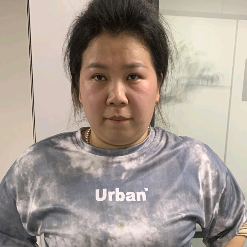 周胖胖(己瘦60斤)