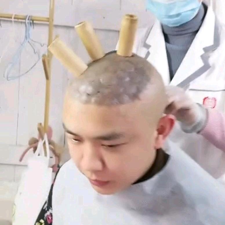 头发复活记
