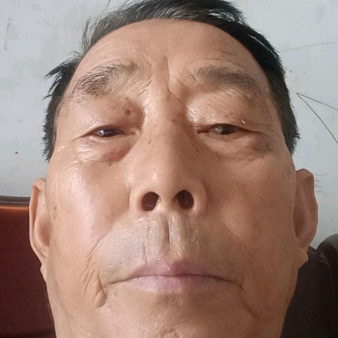 无忧