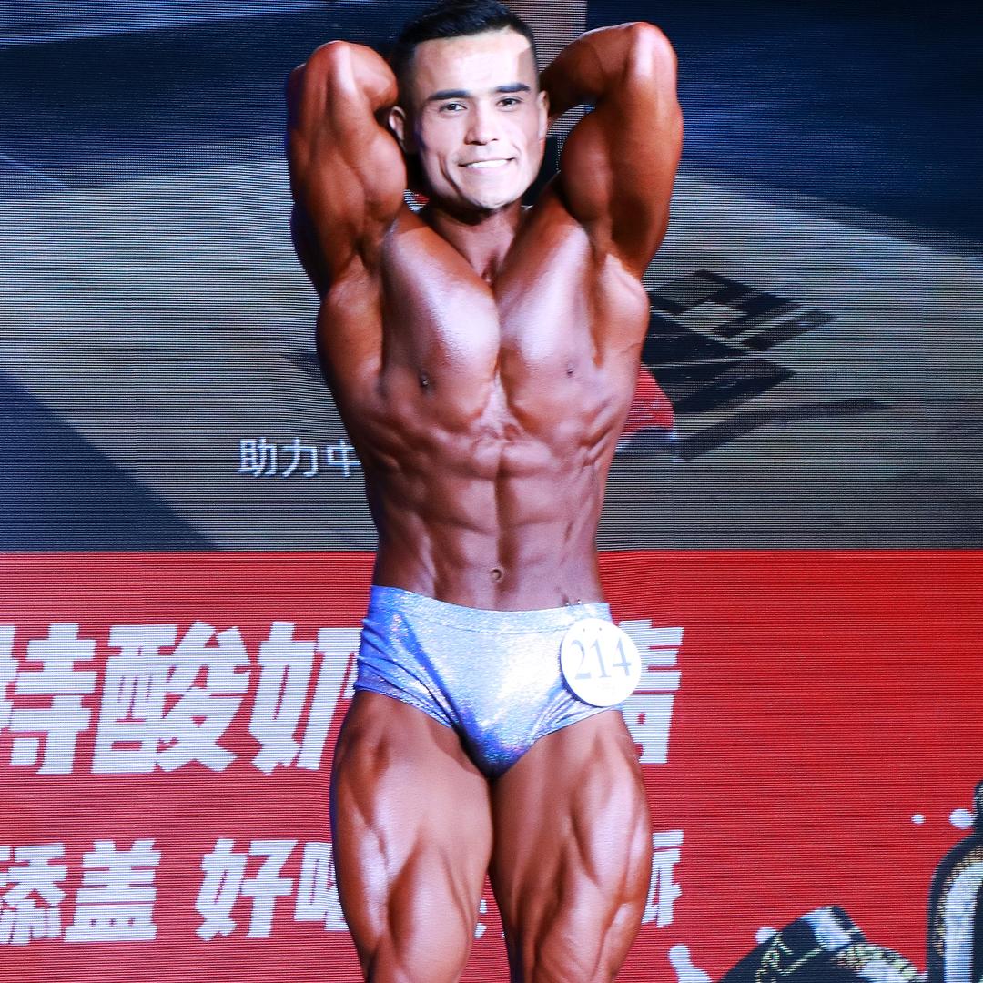 卡尔ER
