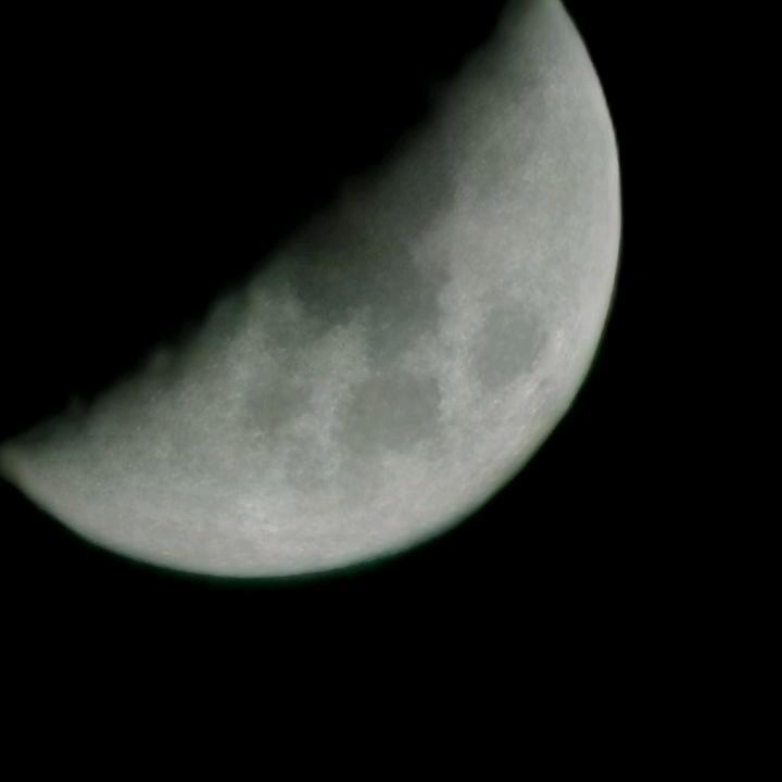 猕猴桃🥝🥝🥝