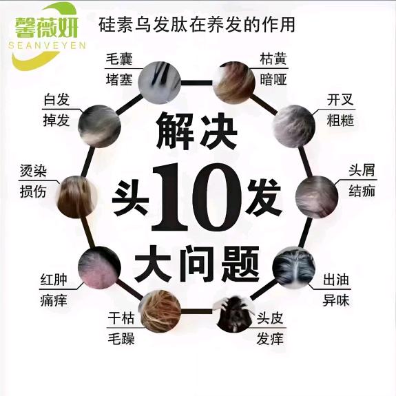 米宜头皮养护小专家