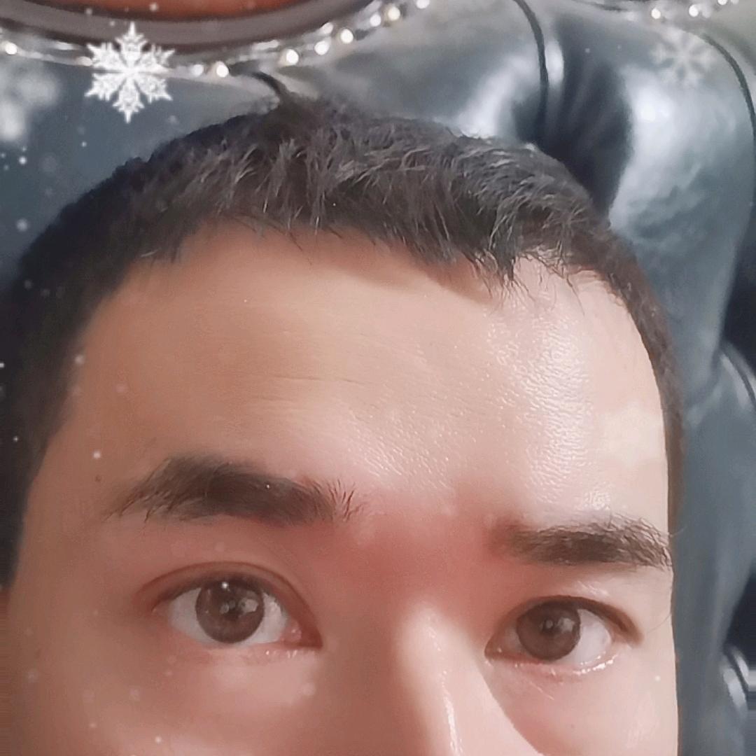 张