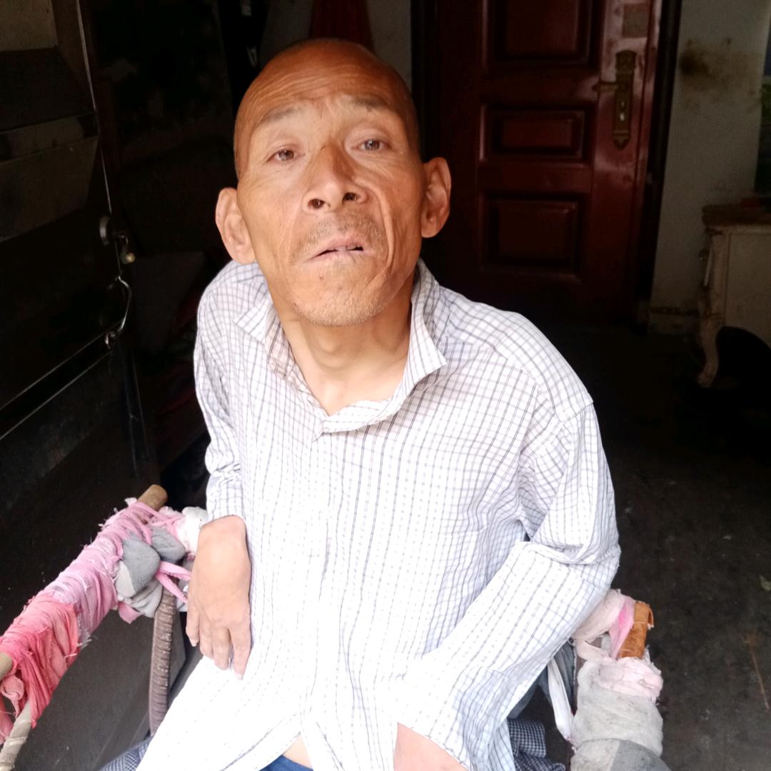 残疾的大叔