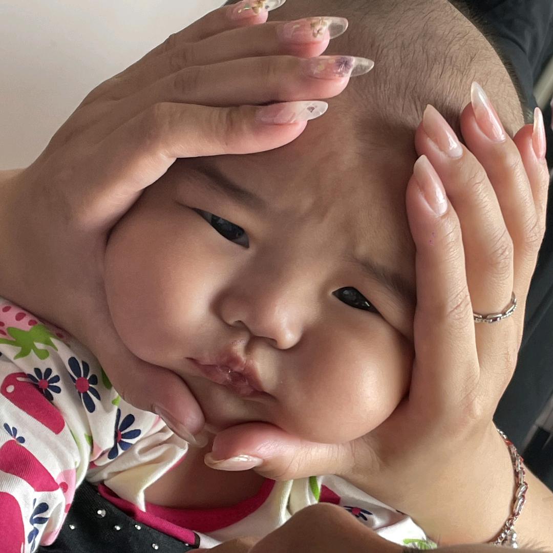 小杨腿掉了