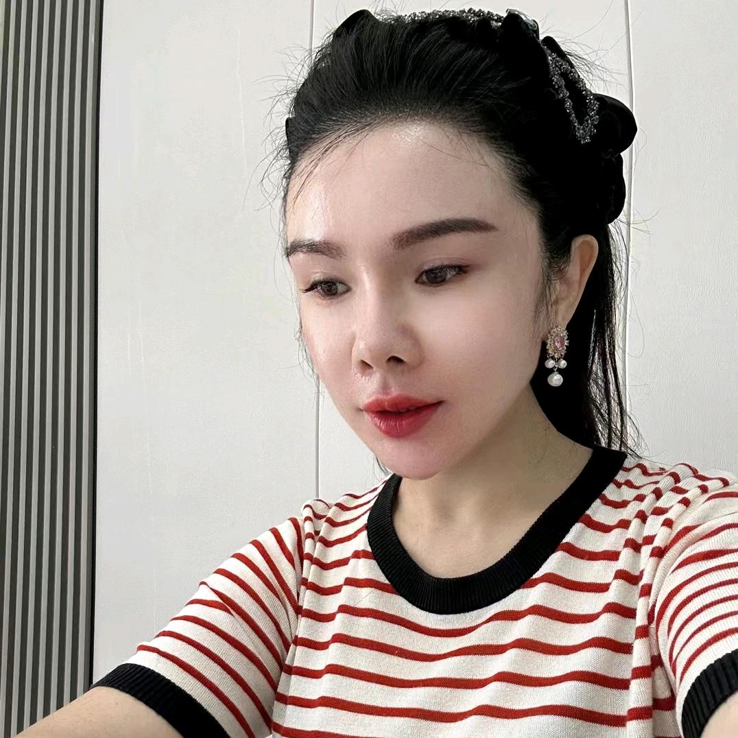 南阳～雅汇～脱发白发