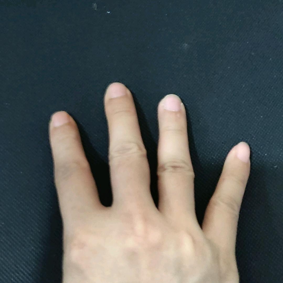 （维权）