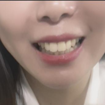 倩倩