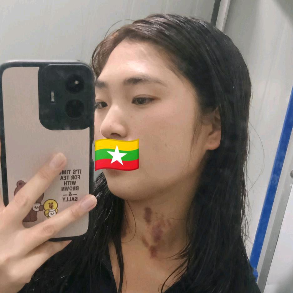 啊依