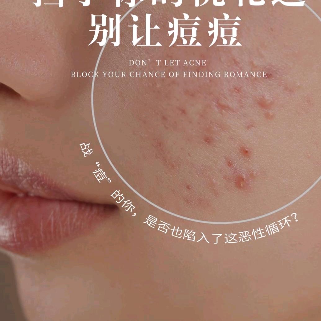 丽颜妆痘敏特调