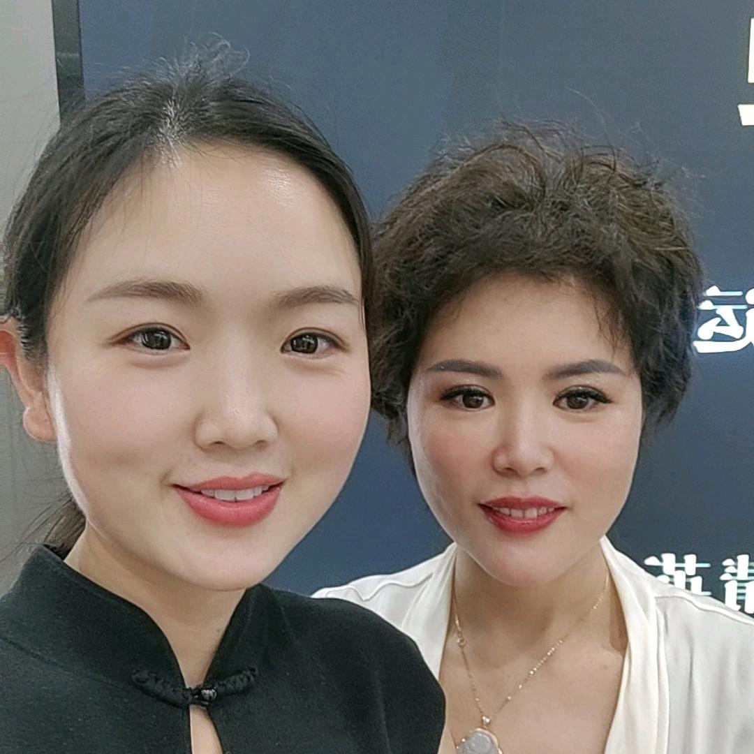 石门斑痘孙艳3
