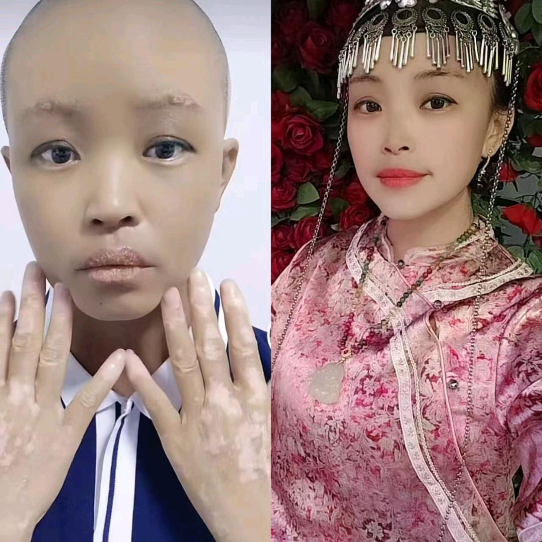 杨新芝抗白白
