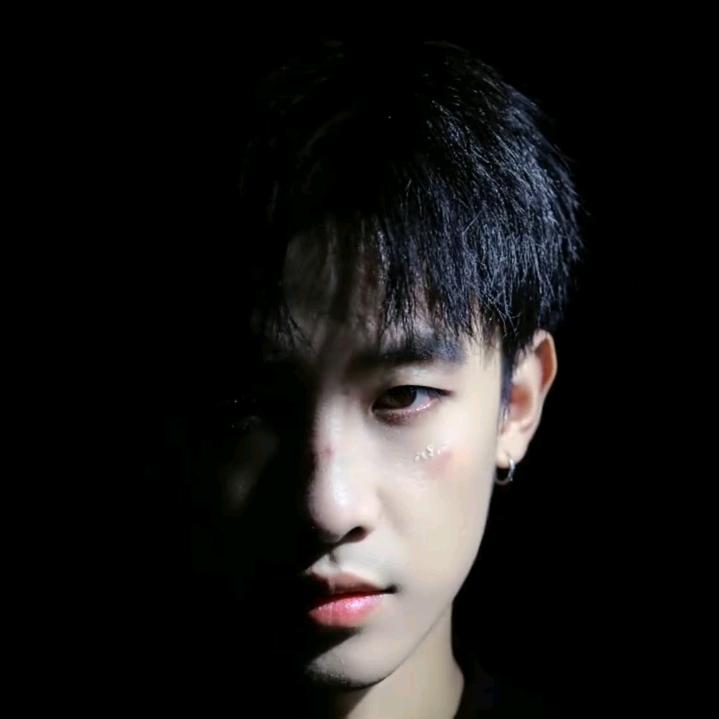 孟德综合症患者。