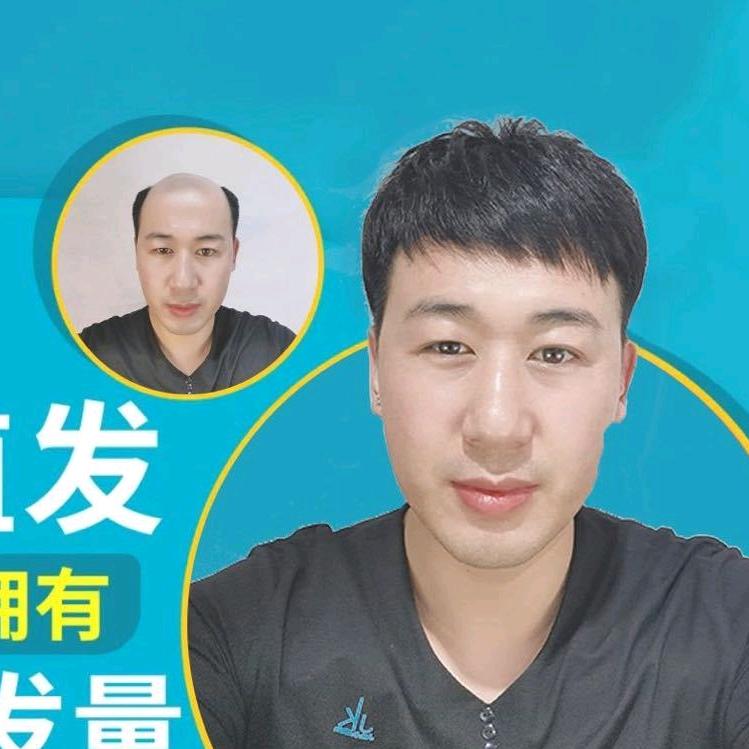 银川牛先生假发补发定制
