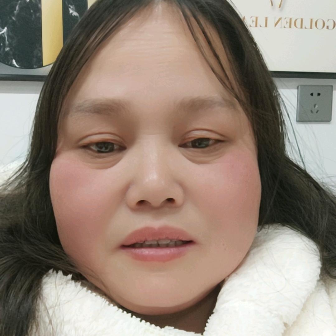 娟娟