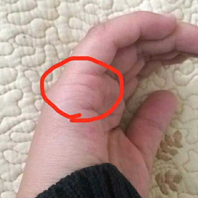 观手知健康