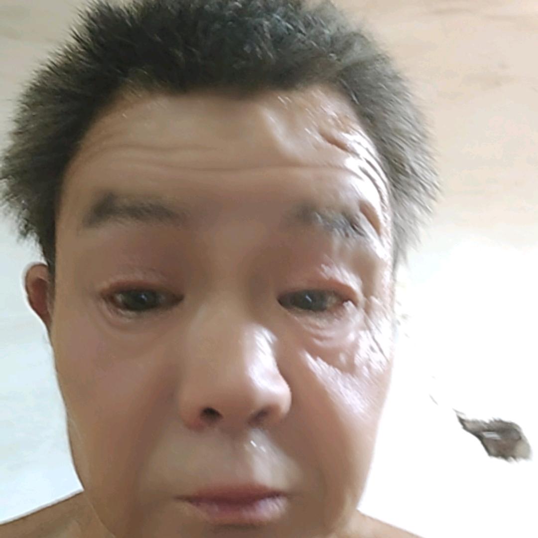 万年红